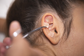 Auriculoterapia (iniciación)